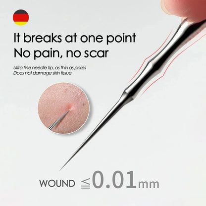 German Blackhead Removal Needle Tool for Clear Skin - Smarsty