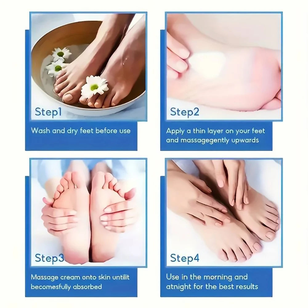 SUYARUN 60% Urea Foot Cream for Cracked Heels & Dry Skin - Intensive Moisturizing Treatment, Callus Remover, Diabetic Foot Care. - Smarsty