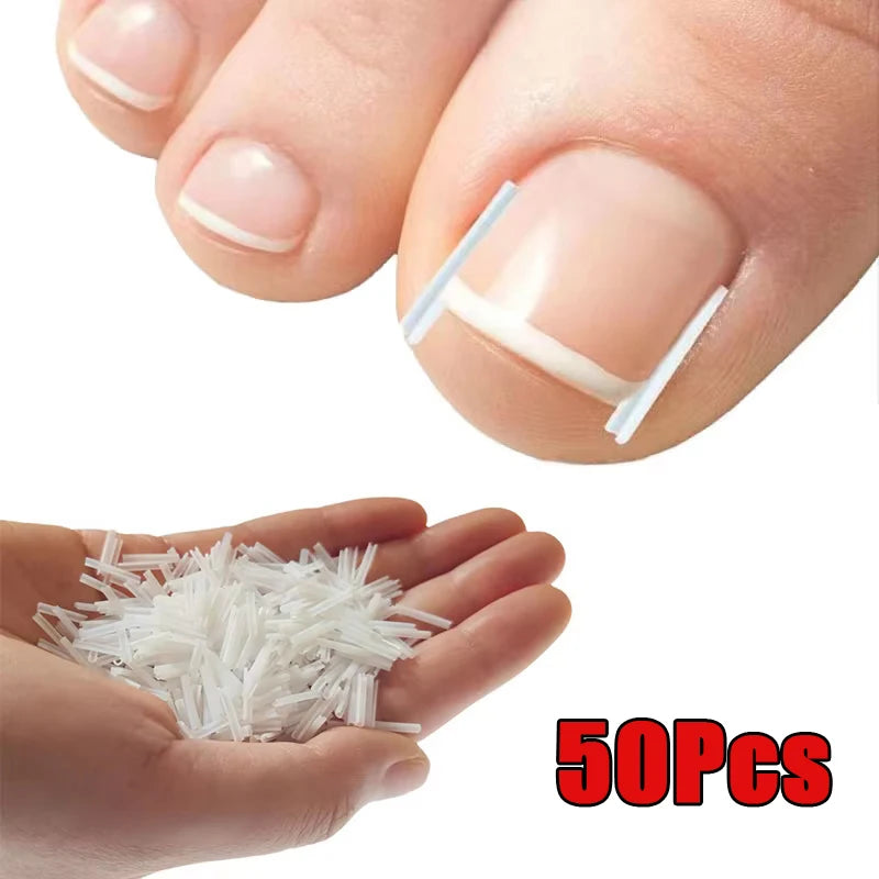 Ingrown Toenail Correction Tool with Elastic Patch - Smarsty