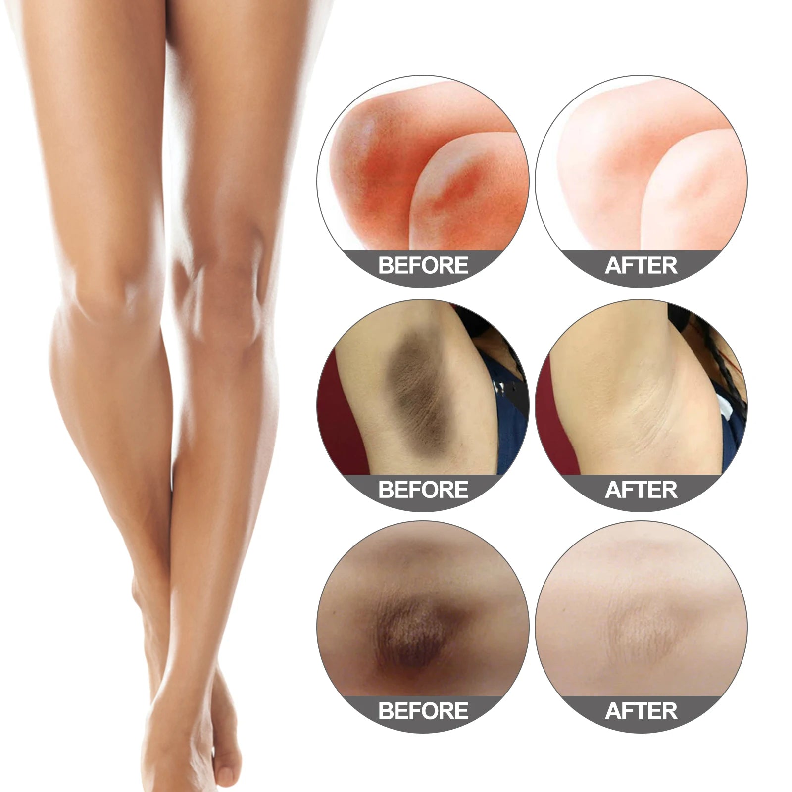 Body Snow Bleach Cream for Dark Spot Removal - Smarsty