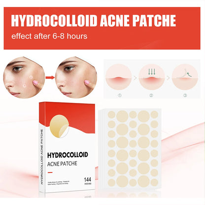 144 Piece Acne Pimple Patch Set for Clear Skin - Smarsty