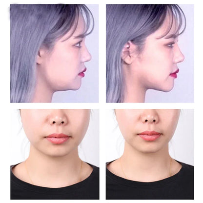 Invisible V Shape Face Lift Stickers for Wrinkle Reduction - Smarsty