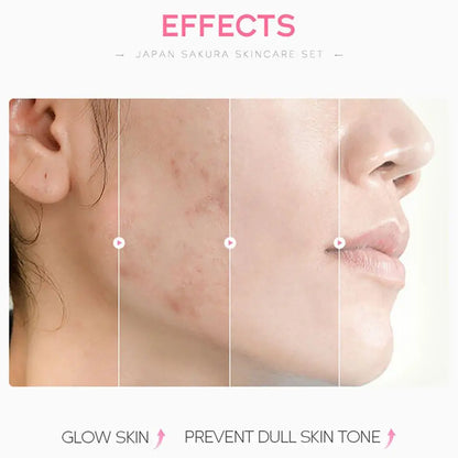 5/3pcs/Set Sakura Skin Care Sets Face Cream Serum Toner Facial Cleanser Sunscreen Eye Cream Gift Box Face Skin Care Set Product - Smarsty