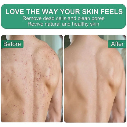 Exfoliating Bath Scrub Gloves for Smooth Skin - Smarsty