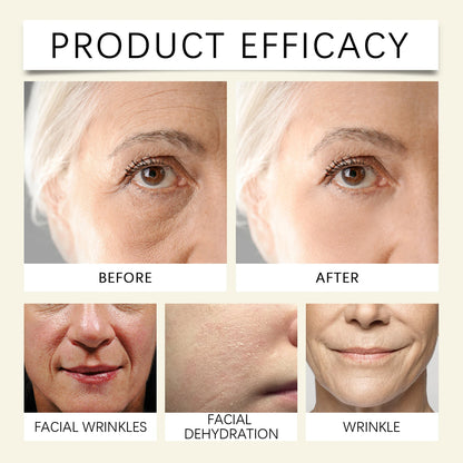 Ouhoe Snail Collagen Face Cream For Moisturizing Anti Aging - Smarsty