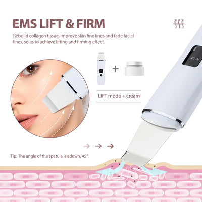Ultrasonic Skin Scrubber Deep Cleansing Blackhead Remover - Smarsty