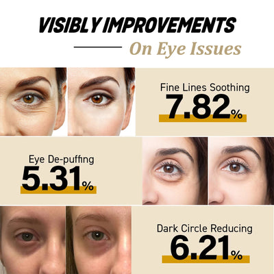 Snail Eye Cream Stick for Dark Circles and Puffiness - Smarsty