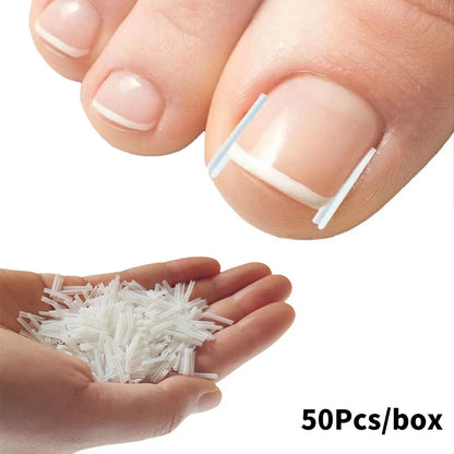 Ingrown Toenail Correction Strips for Pain Relief - Smarsty