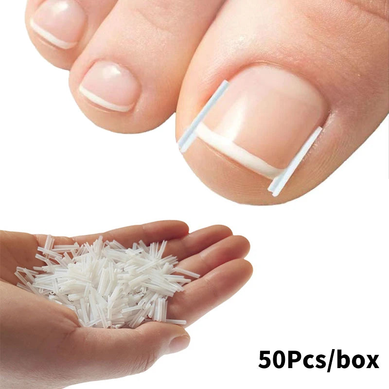 Ingrown Toenail Correction Strips for Pain Relief - Smarsty
