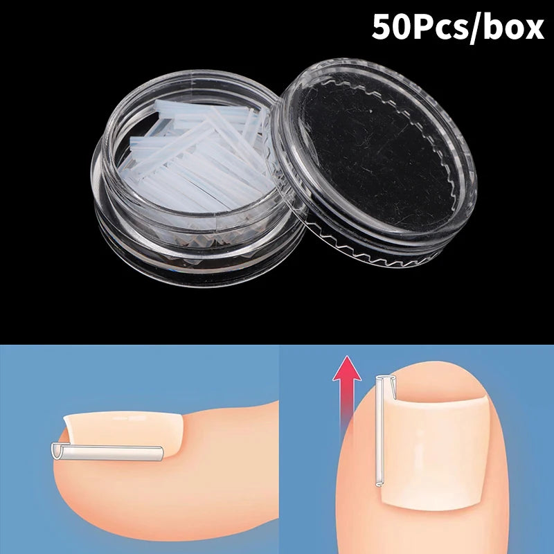 Ingrown Toenail Correction Strips for Pain Relief - Smarsty