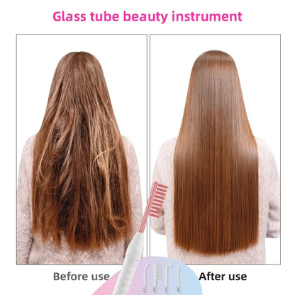 4 in 1 High Frequency Acne Treatment Wand - Smarsty