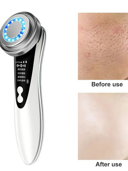 5 In 1 Facial Massager with LED Light Therapy - Smarsty