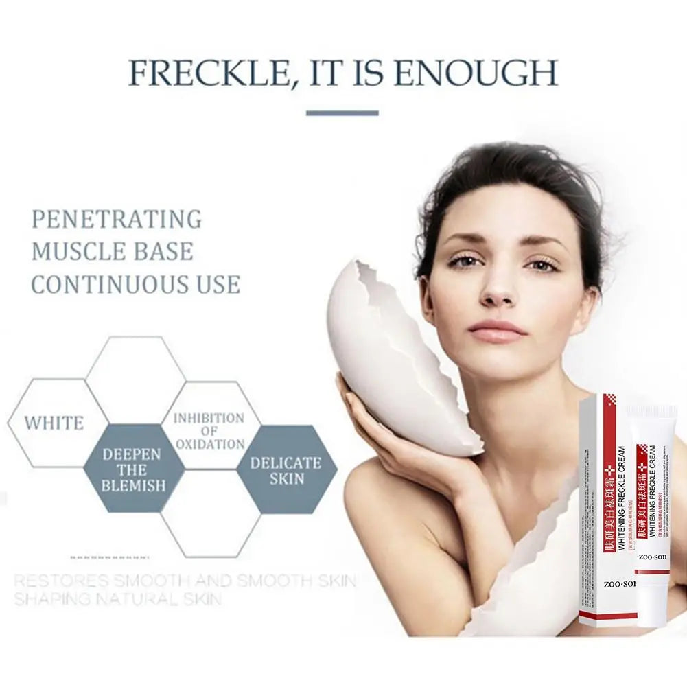 Whitening Freckle Cream for Dark Spot Removal - Smarsty