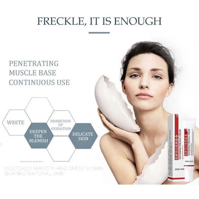 Whitening Freckle Cream for Dark Spot Removal - Smarsty