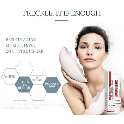 Whitening Freckle Cream for Dark Spot Removal - Smarsty