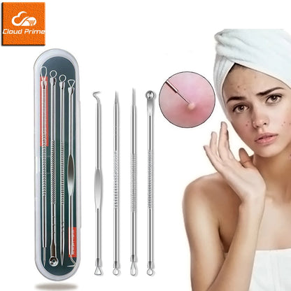4PCS Acne Remover Tool Set for Clear Skin - Smarsty