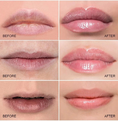 Lemon Ginger Lip Balm for Dark Skin Removal - Smarsty