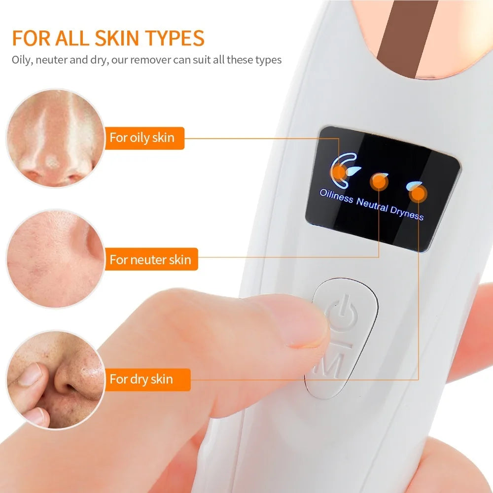 Vacuum Blackhead Remover With USB Charging Convenience - Smarsty