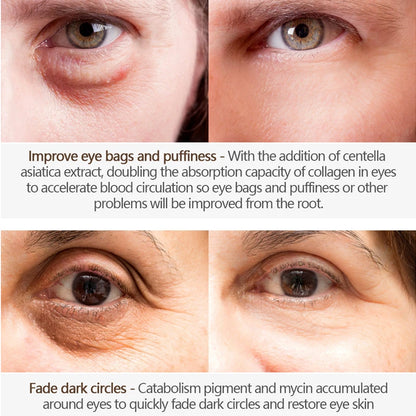 Nicotinamide Eye Cream for Dark Circles and Puffiness - Smarsty