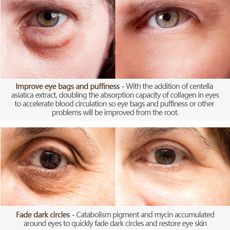 Nicotinamide Eye Cream for Dark Circles and Puffiness - Smarsty