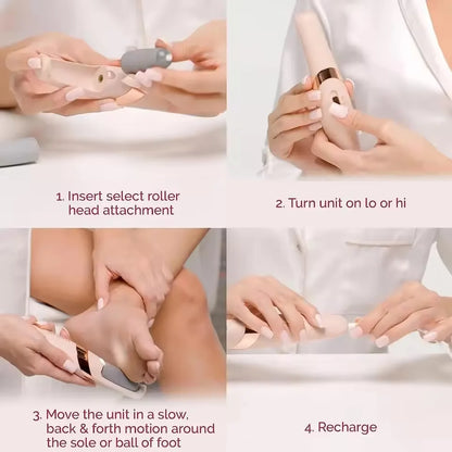 Rechargeable Electric Foot Callus Remover for Smooth Skin - Smarsty