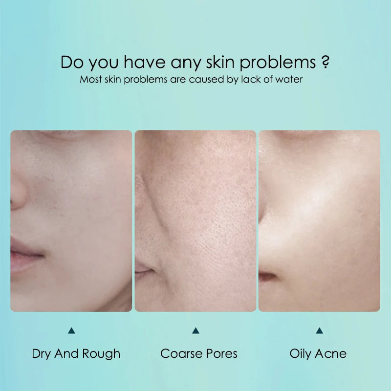 Hyaluronic Acid Hydrating Facial Mask 10 Pack - Smarsty