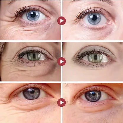 Instant Eye Bag Removal Cream for Dark Circles - Smarsty