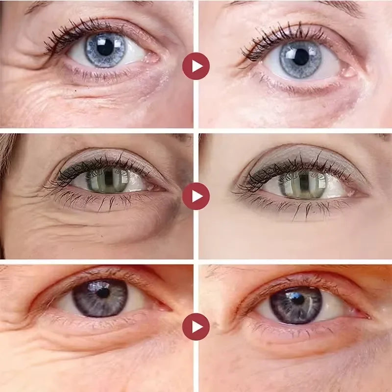 Instant Eye Bag Removal Cream for Dark Circles - Smarsty