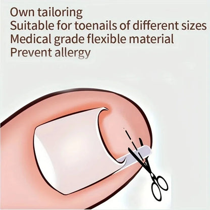 50Pcs Ingrown Toenail Correction Pads for Pain Relief - Smarsty