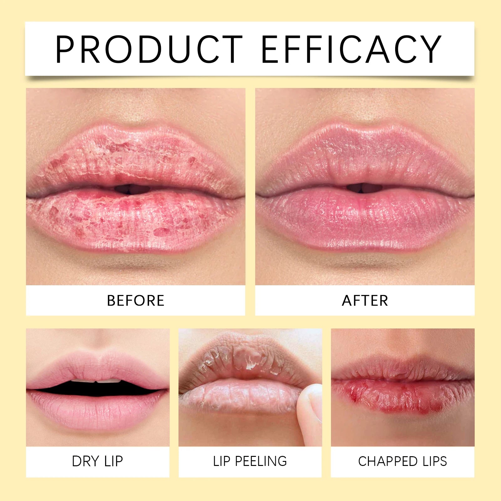 Lemon Ginger Lip Balm for Nourished Smooth Lips - Smarsty