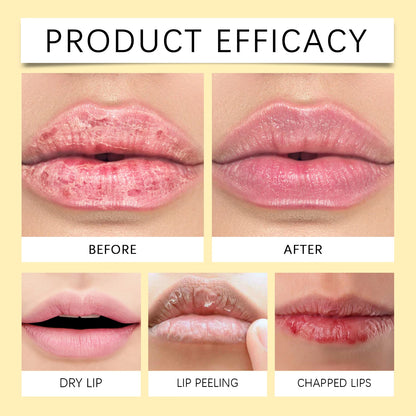 Lemon Ginger Lip Balm for Nourished Smooth Lips - Smarsty