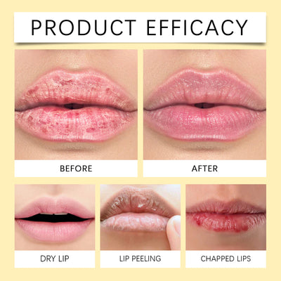 Lemon Ginger Lip Balm for Dark Skin Removal - Smarsty