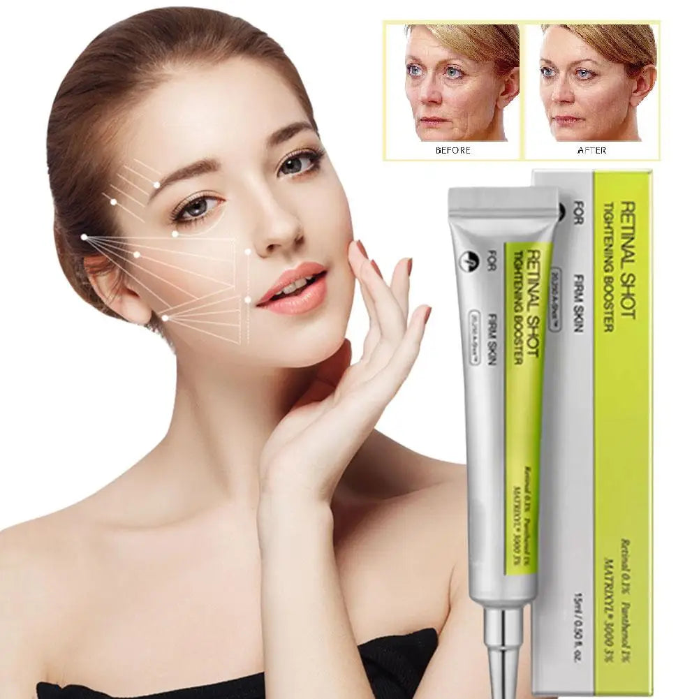Korean Retinol Moisturizing Essence Exfoliating Eye Cream Moisturizer Rejuvenate Shrinks Pores Moisturiz Brighten Skin Care - Smarsty
