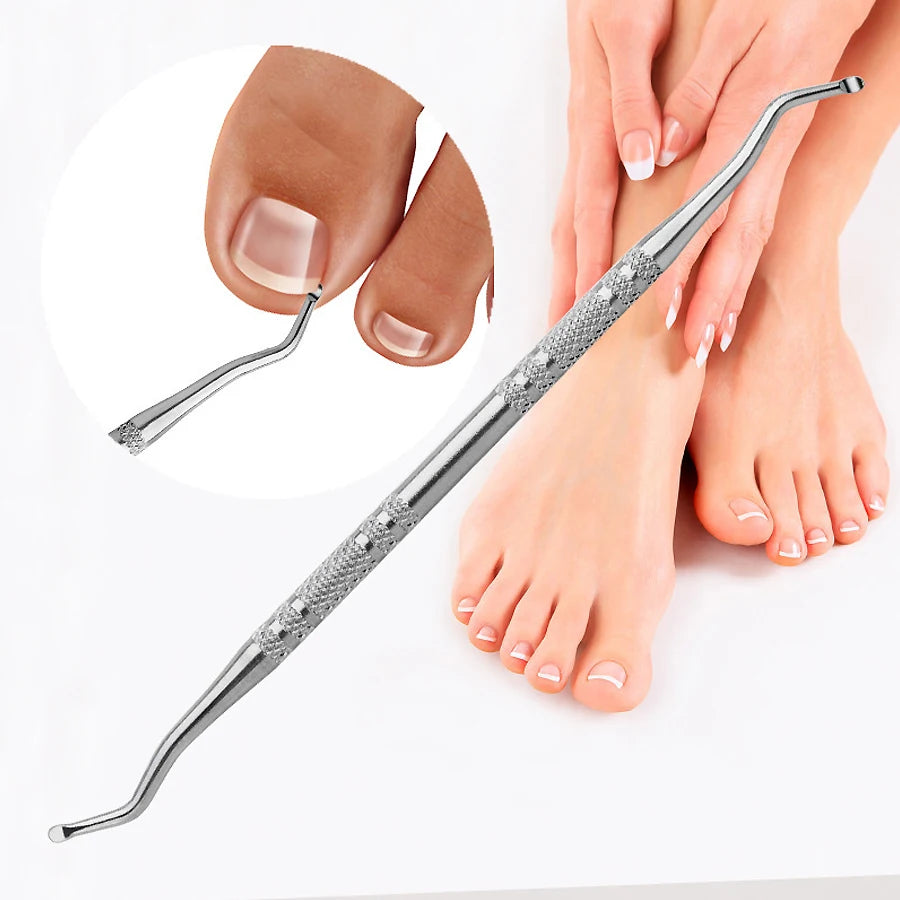 Ingrown Toenail Correction Tool Set for Paronychia Care - Smarsty