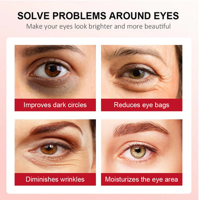 Retinol Eye Cream for Dark Circles and Firming - Smarsty