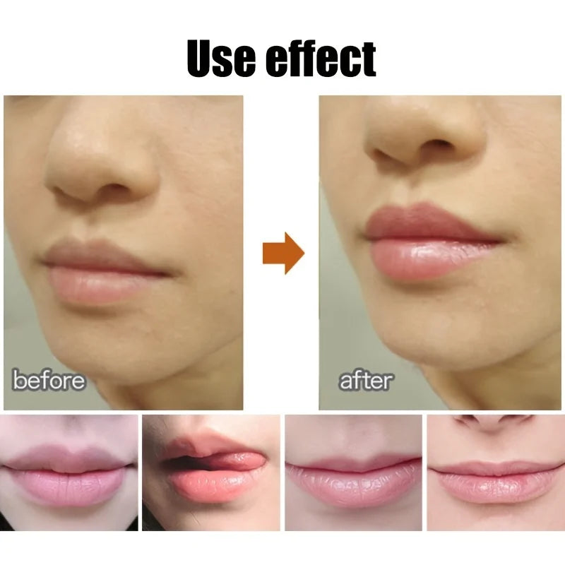 Cute Ball Shaped Lip Balm for Hydration and Soothing - Smarsty