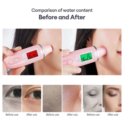 CO2 Oxygen Bubble Pen 5 Gear Vibration Oxygen Bubble Beauty Tool Deep Cleansing Pores Exfoliate LED Photon Skin Care Machine