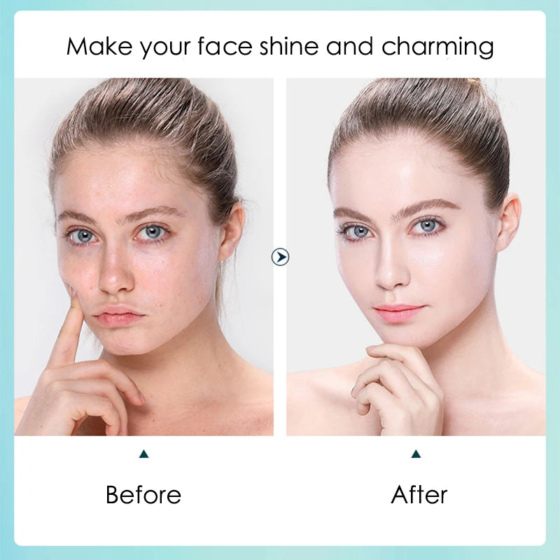 Hyaluronic Acid Hydrating Facial Mask 10 Pack - Smarsty