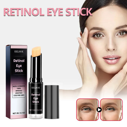 Retinol Eye Cream Stick for Dark Circles and Puffiness - Smarsty