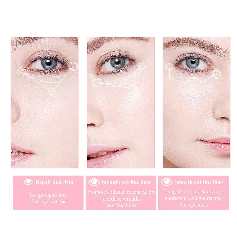 Retinol Eye Cream for Dark Circles and Puffiness - Smarsty