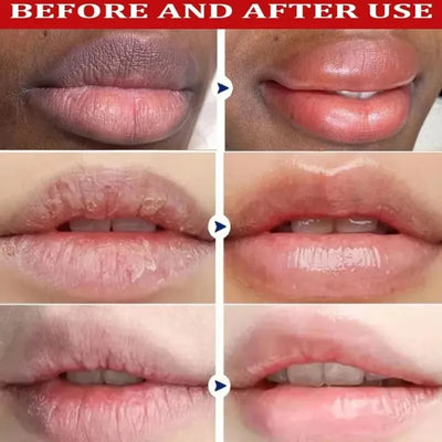 Dark Lip Lightening Balm for Moisturizing and Exfoliating - Smarsty