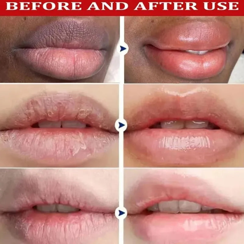Dark Lip Lightening Balm for Moisturizing and Exfoliating - Smarsty