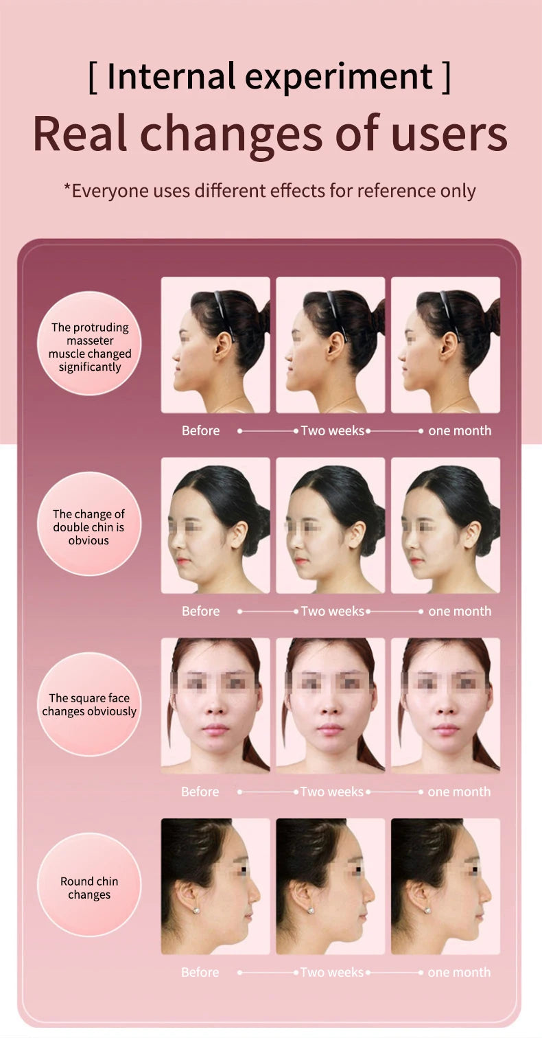LED Facial Slimming Massager for V Face Lift - Smarsty