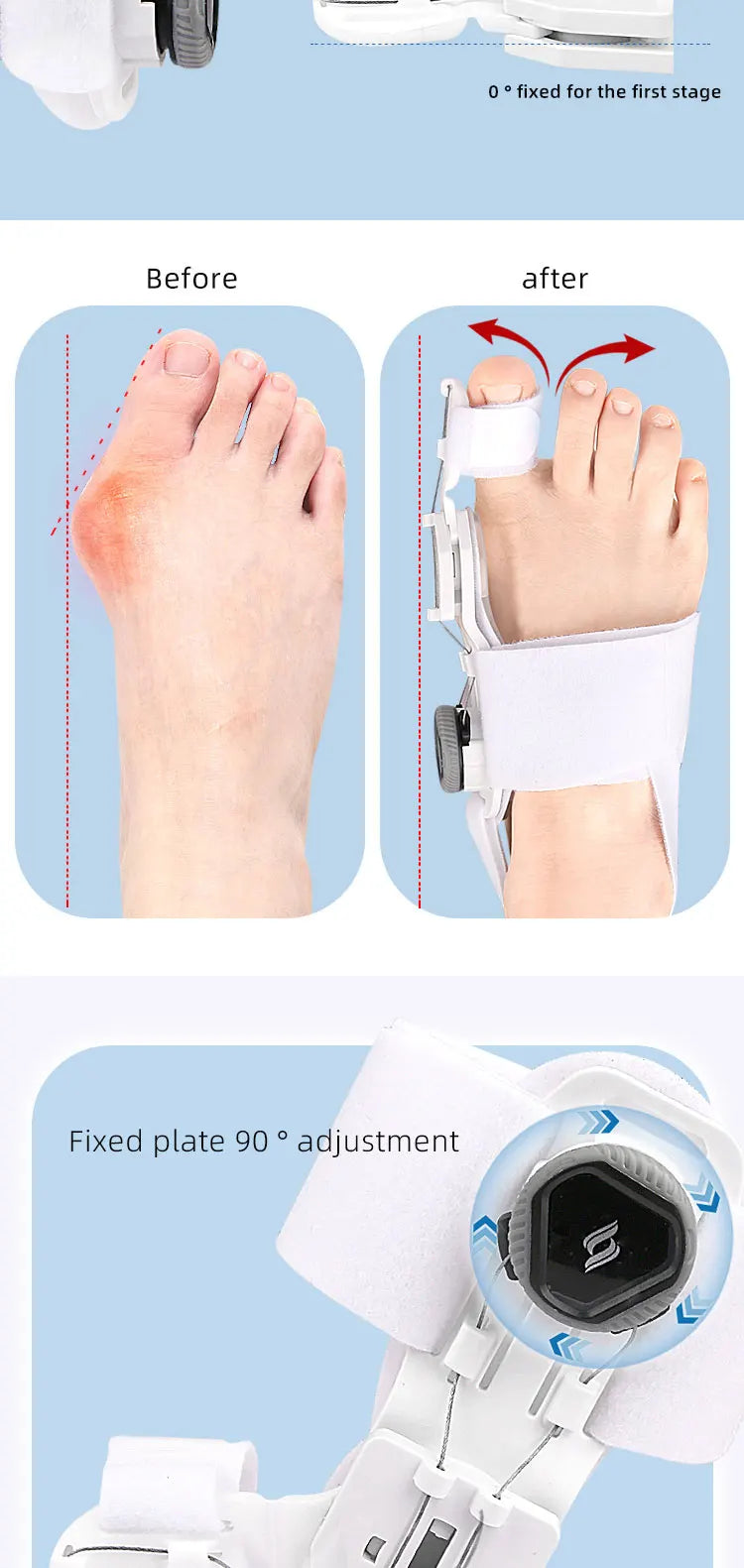 Bunion Corrector Adjustable Rotatable Toe Separator - Smarsty