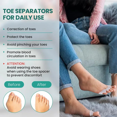 Silicone Toe Separators for Bunion Correction and Foot Comfort - Smarsty