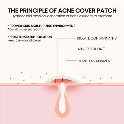 Effective Acne Repair Patch for Fading Blemishes - Smarsty