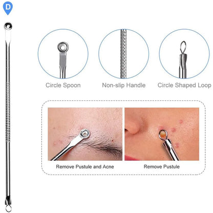 4PCS Acne Remover Tool Set for Clear Skin - Smarsty