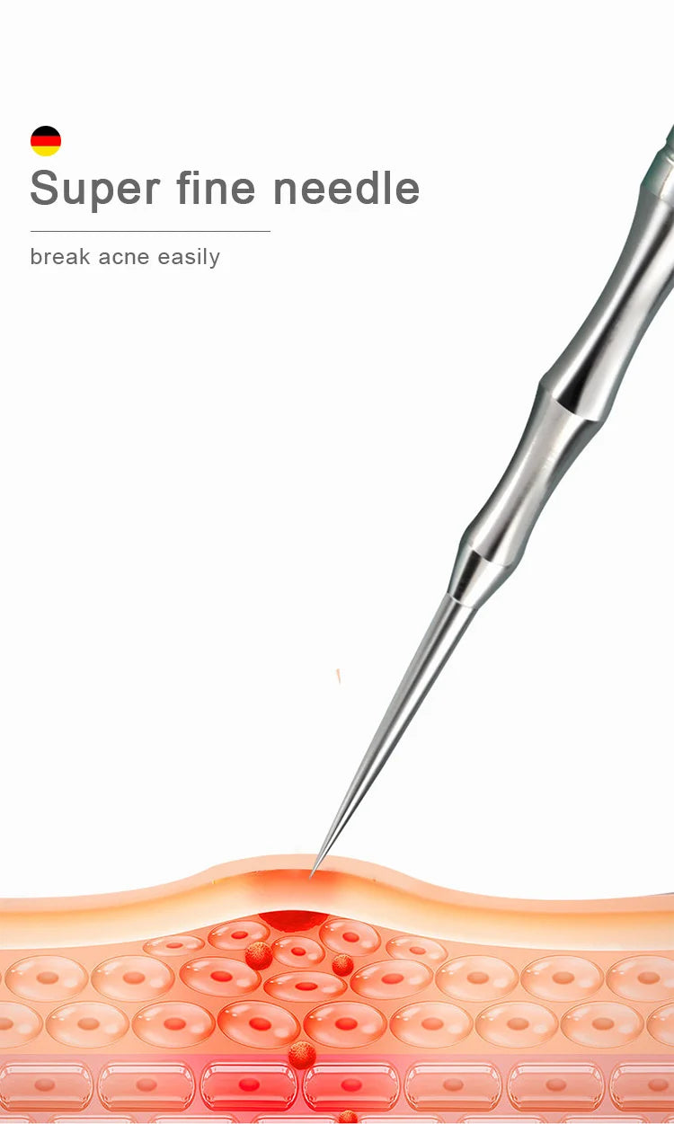 German Blackhead Removal Needle Tool for Clear Skin - Smarsty