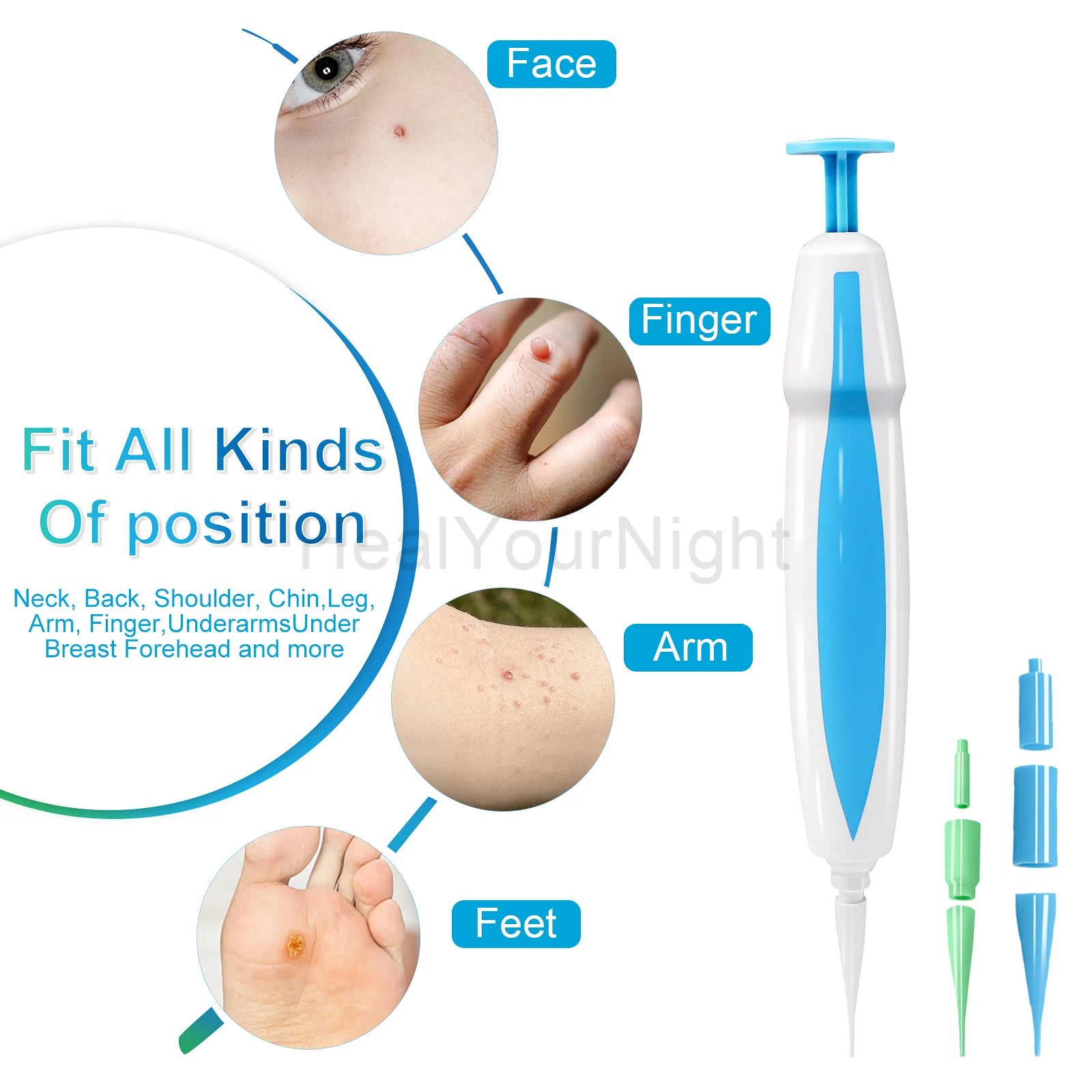 3 In 1 Painless Skin Tag Removal Kit - Smarsty