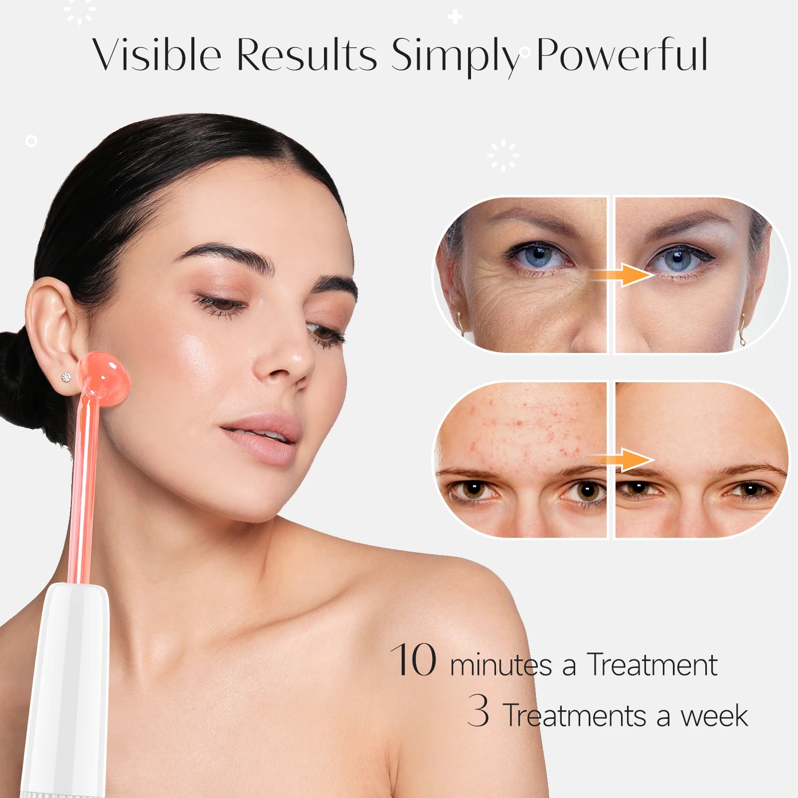 Darsonval High Frequency Wand for Acne and Wrinkle Treatment - Smarsty